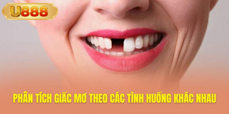 Luận giải chi tiết các kịch bản cụ thể mơ thấy rụng răng